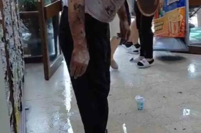 Bursa’da lavaboyu açmak için dökülen kimyasal madde patladı: 2 yaralı
